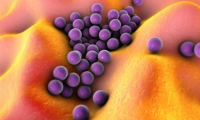 MRSA CC398 found in ASDA and Sainsbury's pork products